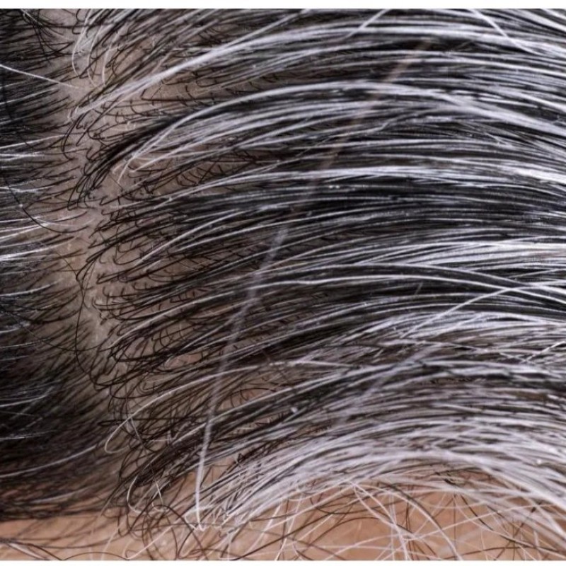 Gray Hair