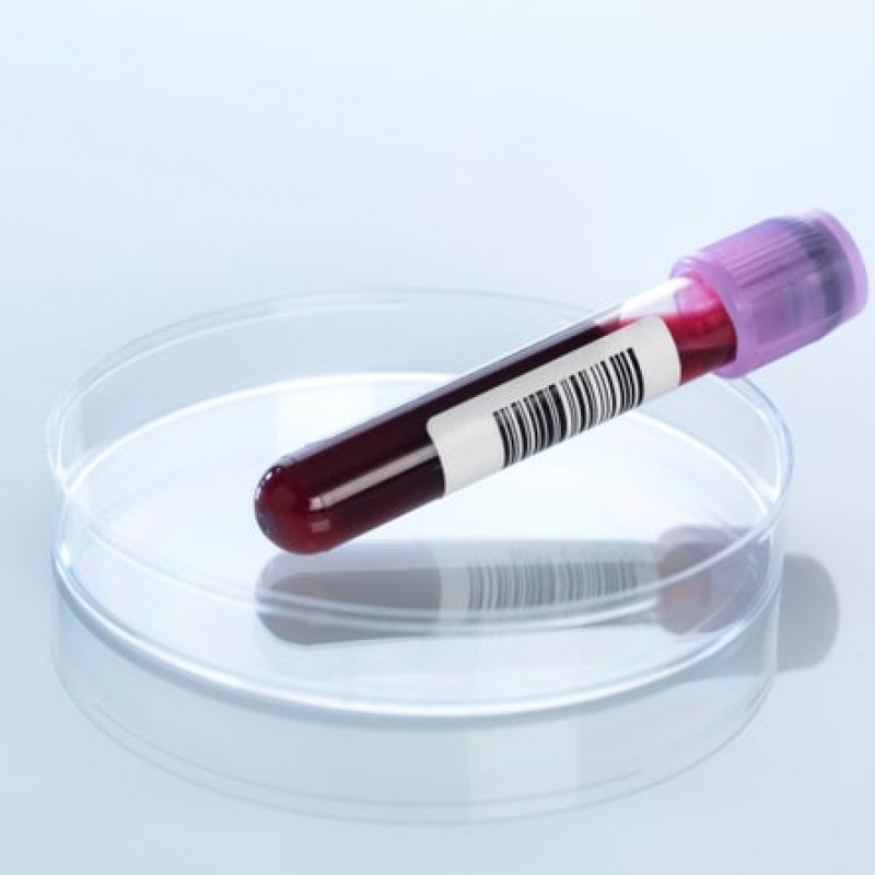 When to do blood tests