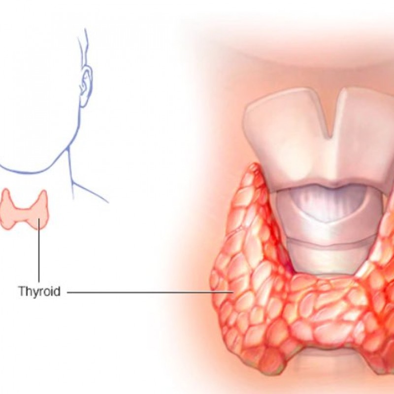 الغدة الدرقية والقلب